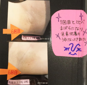 ビフォーアフター