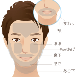 メンズ脱毛お顔部位