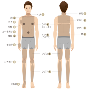 メンズ脱毛身体SL部位