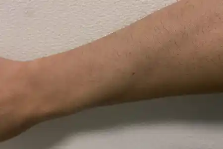 エミナルクリニックメンズ(旧メンズエミナル)をおすすめする人・しない人