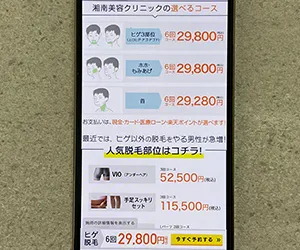 1-4.湘南美容クリニック｜1回5,700円の都度払いでヒゲ3部位を脱毛できる