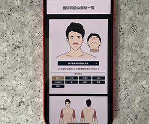 ゴリラクリニック札幌院〈すすきの駅徒歩3分・男性看護師によるVIO対応〉