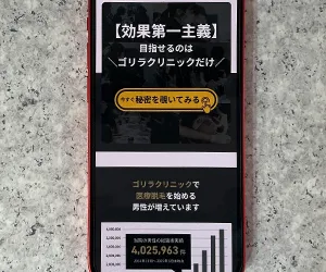 ゴリラクリニック大阪心斎橋院（熱破壊式ヤグレーザーを全院に設置）