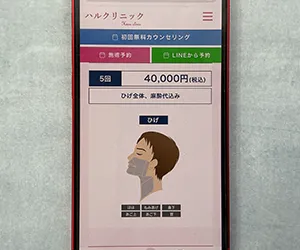 ハルクリニック｜麻酔代もキャンセル料も無料