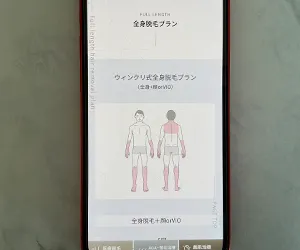 ウィンクリニック神戸三宮院（JR三ノ宮駅徒歩2分／ジェントルマックスプロプラス採用）