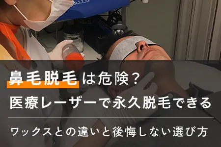 鼻毛脱毛は危険？医療レーザーで永久脱毛できる8院｜ワックスとの違いと後悔しない選び方